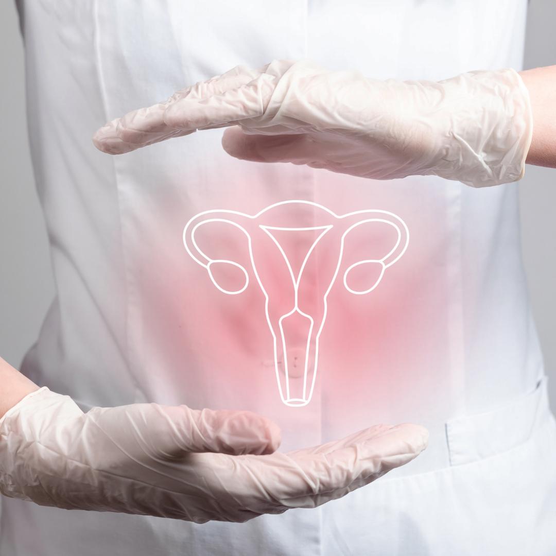 Polistik Over Sendromu